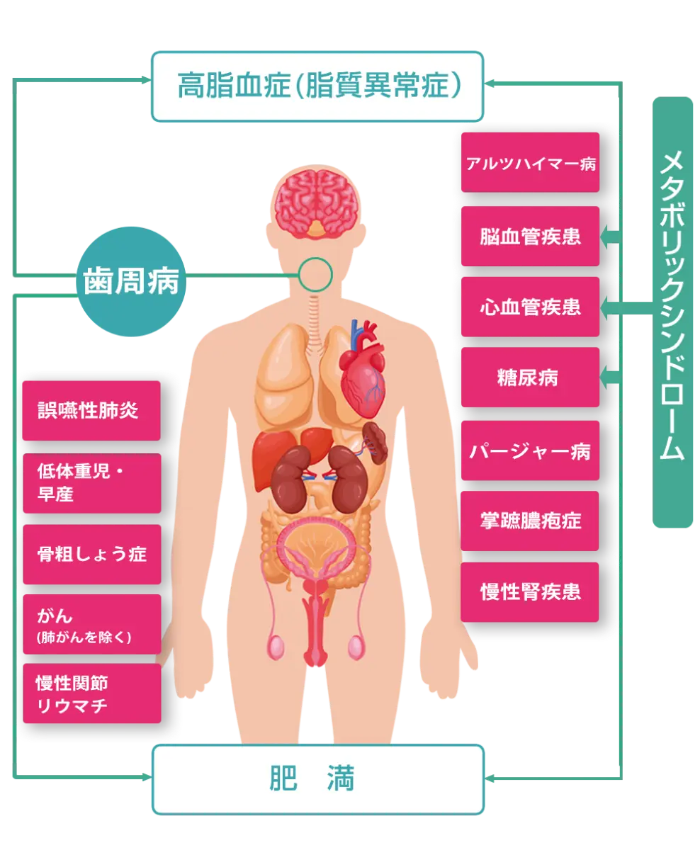 歯周病と全身疾患